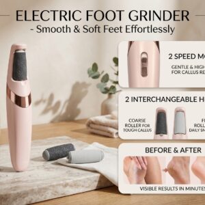 Electric Foot Grinder & Callus Remover - Rechargeable Pedicure Tool